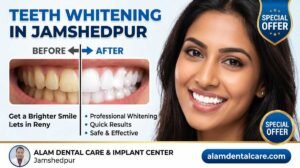 Teeth Whitening in Jamshedpur