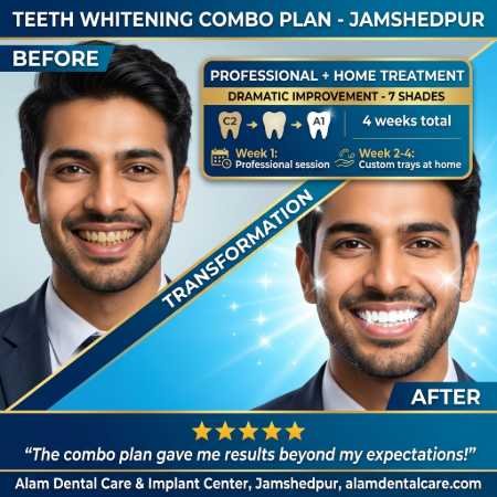 Before and after teeth whitening patient 3 - visible results after custom tray whitening